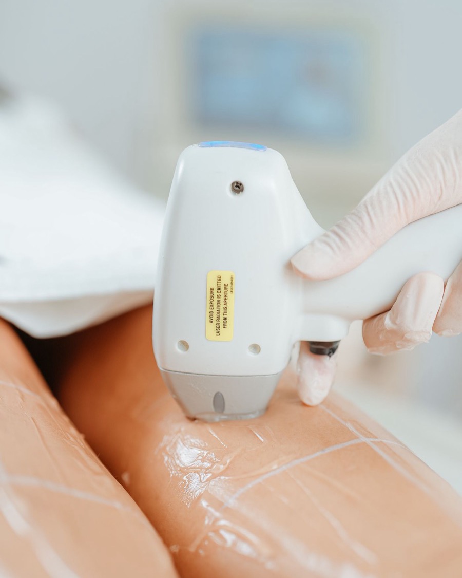 Zonenpaket, Behandlung mehrerer Zonen mit dem Diodenlaser-Handstück